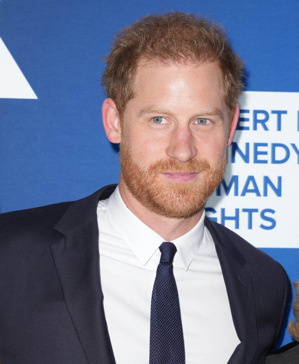 Másnapos vagy? 10 módszer, ami a sztároknak is bevált