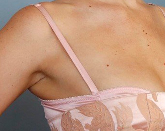 Jennifer Lawrence kitüremkedő melltartóban