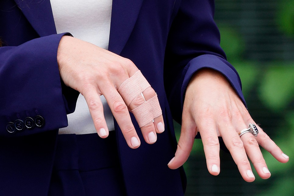 Katalin hercegné a lehető legédesebb körülmények között sérült meg