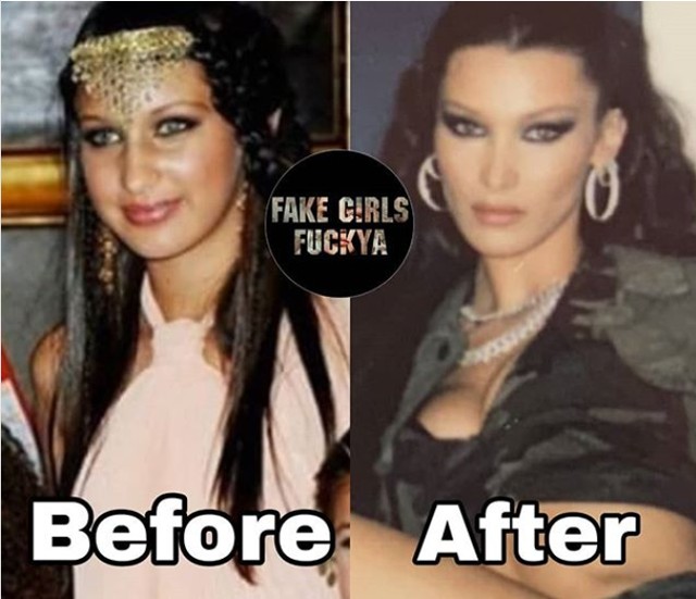 Ezek a fotók bizonyítják, hogy Bella Hadid arcát teljesen átszabták