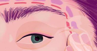 Filler-teória: tudj meg többet az esztétikai és plasztikai beavatkozásokról!