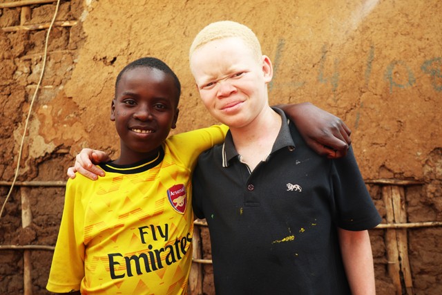 Az albínókat kiközösítik, bántalmazzák, sokszor meg is gyilkolják Afrikában. Szerencsére a gyerekekben nincsenek ilyen előítéletek.