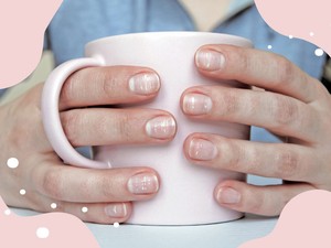 Mit jelentenek a kis fehér foltok a körmödön, és mit tehetsz ellenük?