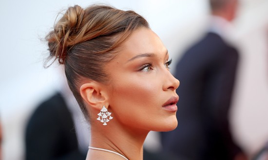 Kifejezetten undorító plasztikai műtét a sztárok hangsúlyos arccsontjának titka 