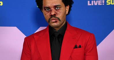 Mi a fene történt The Weeknd arcával?