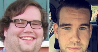 Így változik az ember arca a fogyástól! *Megdöbbentő előtte-utána fotók!*