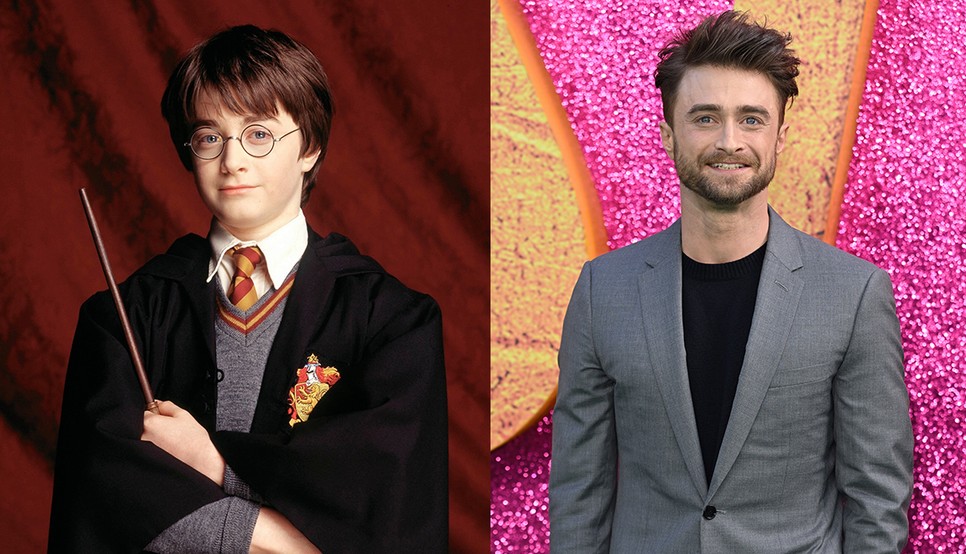  Daniel Radcliffe örökre Harry Potterként égett a retinákba