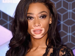 Winnie Harlow egy szál tangában osztja meg életbölcsességeit