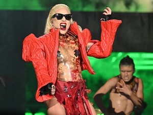 Mi történt Lady Gaga arcával? Hirtelen rá sem ismertünk!