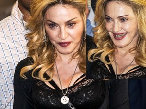 Arany fogszabályzóval riogat Madonna