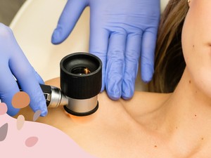 Használd ki a lehetőséget: ingyenes anyajegyszűrés vár a Sziget Fesztiválon!