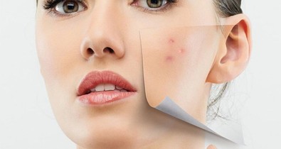 Problémás a bőröd? Tegyél ellene tudatosan!