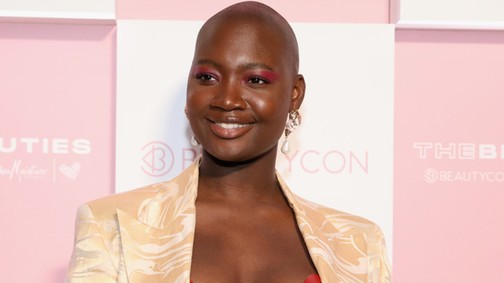 Tragédia! Váratlanul, 30 évesen hunyt el a ráktúlélő, aktivista modell