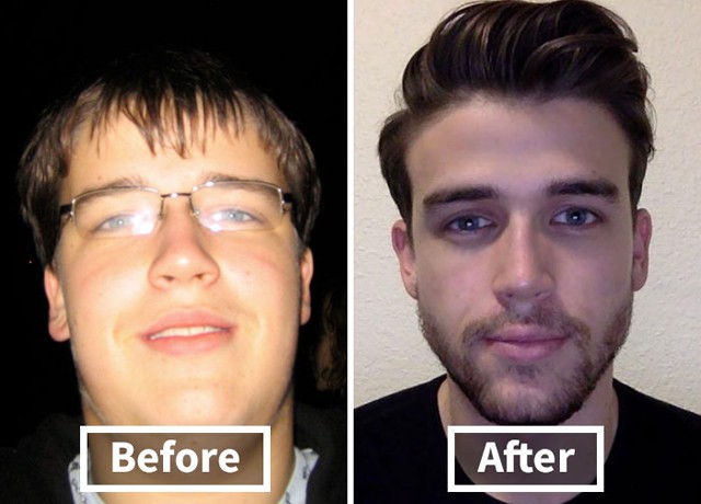 Így változik az ember arca a fogyástól! *Megdöbbentő előtte-utána fotók!*