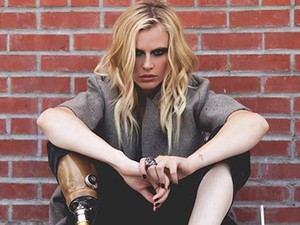 Toxikus sokk miatt elveszítette a lábát, de nem adta fel a modellkarrierjét és most visszatért!