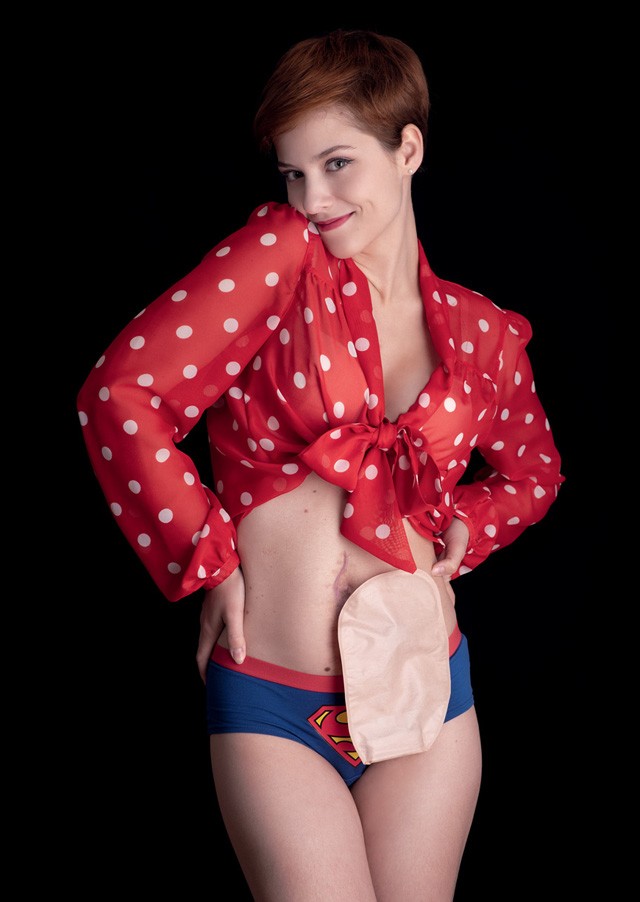 Élet-halál között egy orvosi műhiba miatt