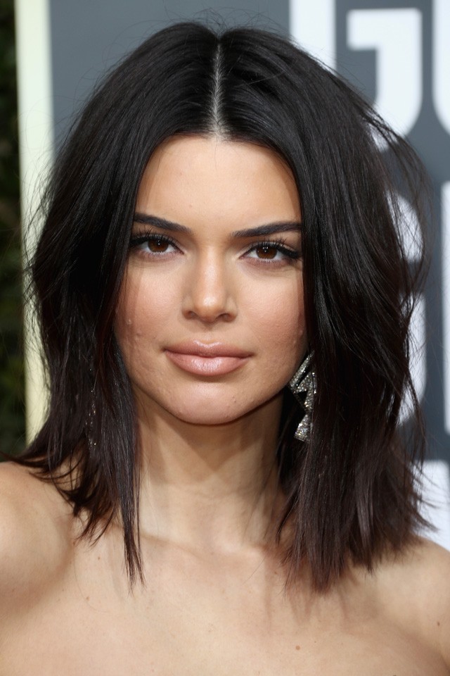 Kendall Jenner pattanásai