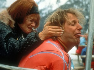 A nyelved tisztítása sokkal fontosabb, mint gondolnád