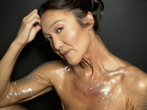 A 26 éves modell drasztikus bőrbetegségtől szenved és most ezt üzeni a világnak!