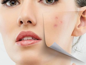Problémás a bőröd? Tegyél ellene tudatosan!