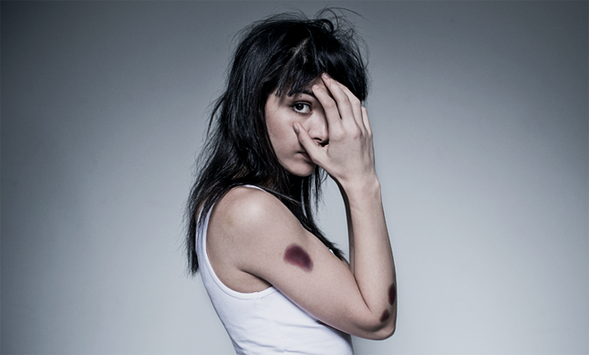 Nekem is fáj! Odettnek is, Szegedi Katának is, Farkas Franciskának is - nekünk is!