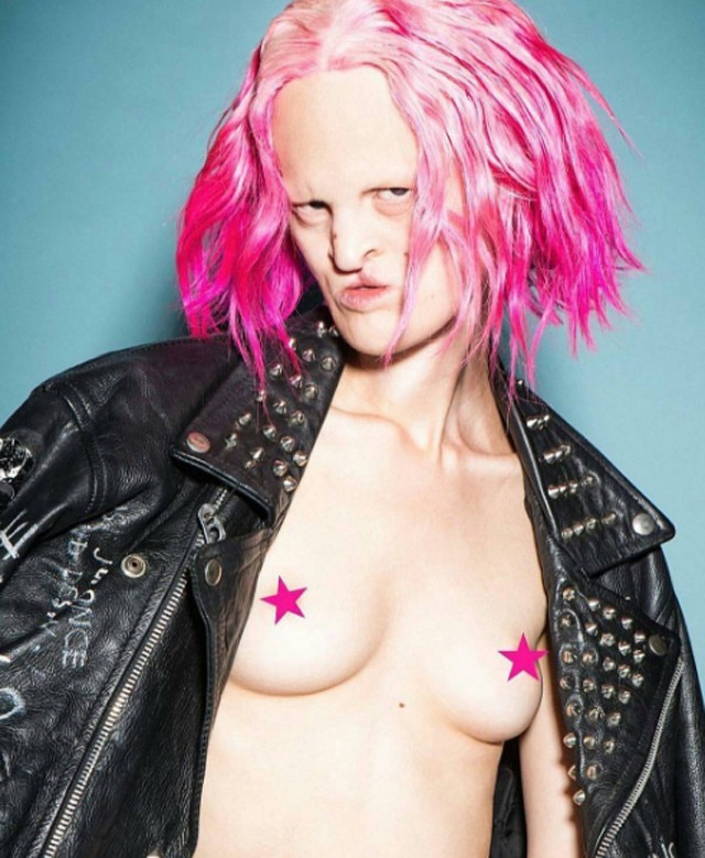 Különös genetikai rendellenességgel küzd a modell, de még ez sem állíthatja meg