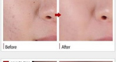 Szenzáció! Ázsiai csodakence