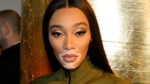 A sztármodellnek turistaosztályon kellett repülnie, hisztizett is egyet