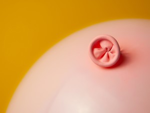 Sokan szégyellik, de az aranyér terhesség alatt is előfordul