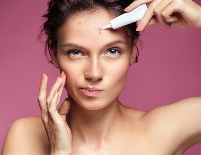 A benzoil-peroxid a legjobb helyi pattanáskezelő, ám sok mellékhatása is van