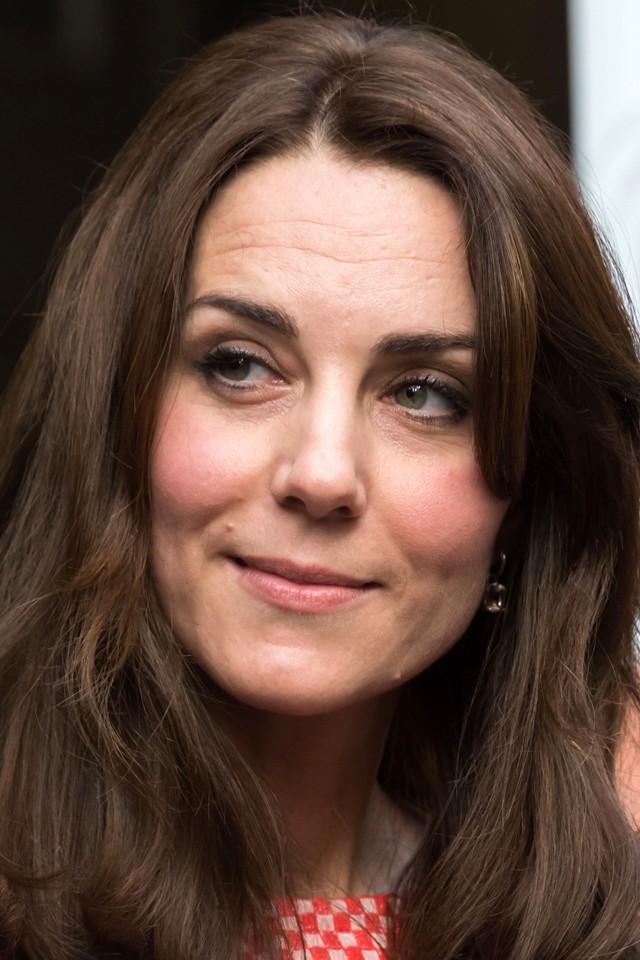 kate middleton, katalin hercegné, plasztika, botox, cambridge
