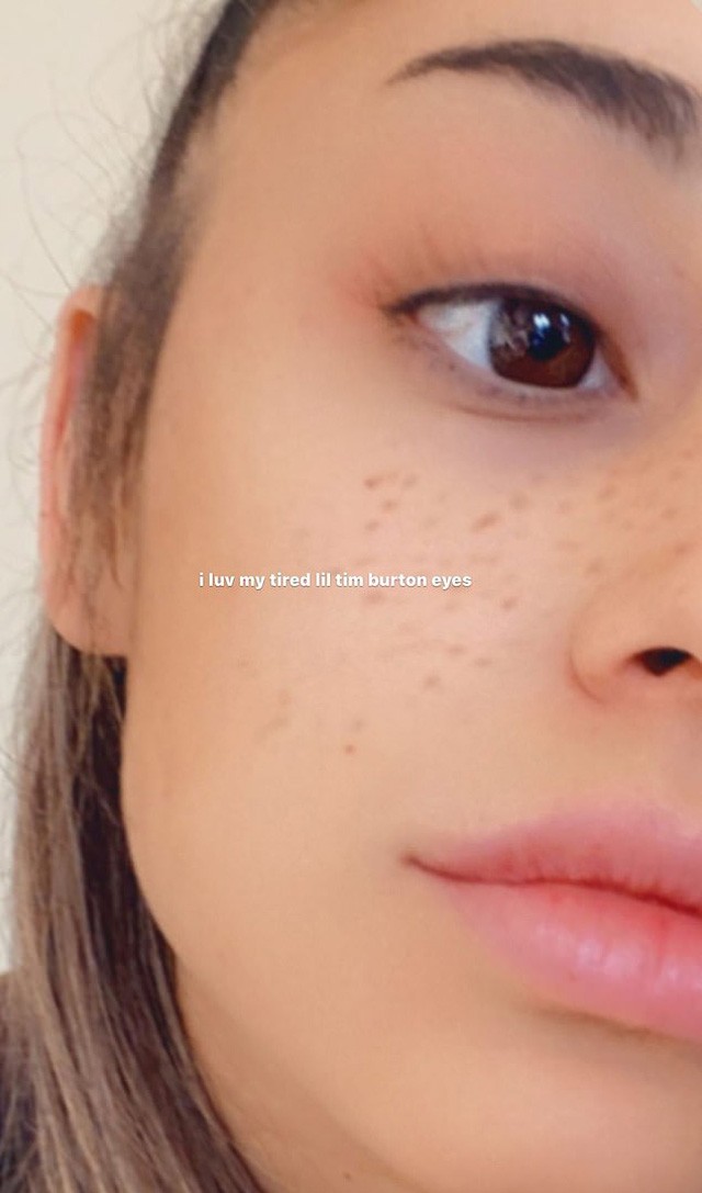 Ariana Grande szeplői