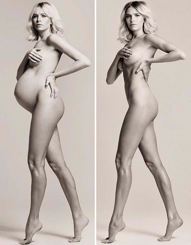 Előtte-utána: aktfotókon várandósan és most