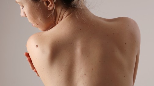 3 tipp, hogy igazán tudatosan ápold a bőröd