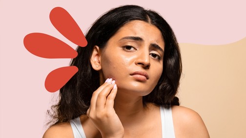 Ezt műveli bőröddel a stressz: szakértő világított rá a problémára