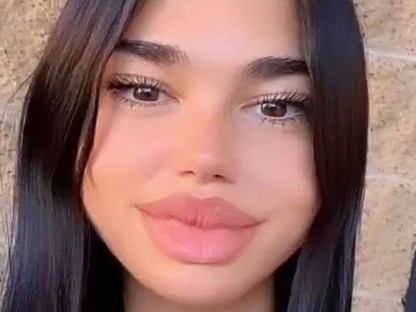 Az Instagram betiltja a plasztikai műtét-hatású kamufiltereket