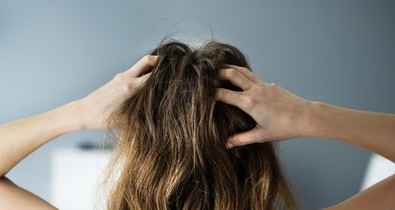 5 meglepő ok, ami miatt viszkethet a fejbőröd