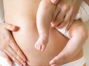 6 tipp, hogy szülés után is feszes legyen a bőr a hasadon