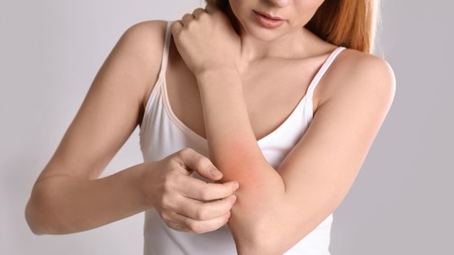 Atópiás a bőröd? Így ápold!