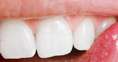 Rossz fogak számos betegség hátterében