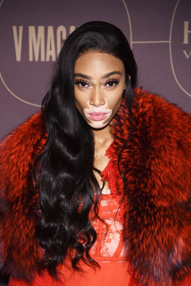 Winnie Harlow