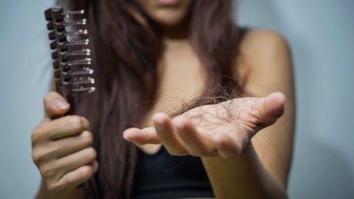 Állítsd meg a hajhullást! A bőrgyógyász most válaszol a leggyakoribb kérdésekre