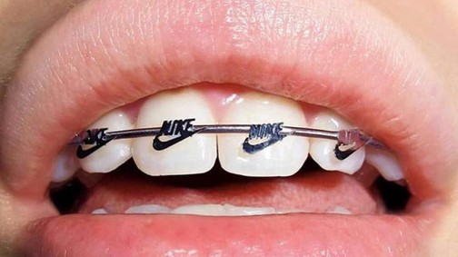 Megtanítunk: így kell kiejteni a világmárkák nevét