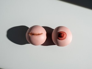 Így kaptam vissza nőiességem a mellamputációm után