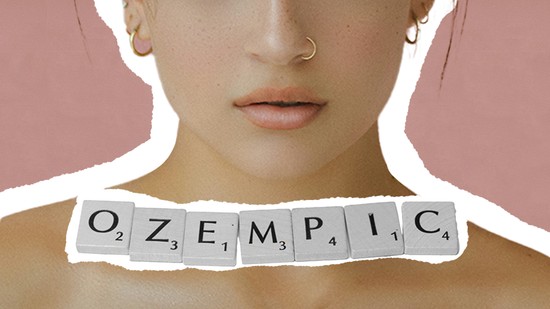 Ijesztő, hogyan változtatja meg a bőrt az Ozempic: plasztikai sebészek figyelmeztetnek