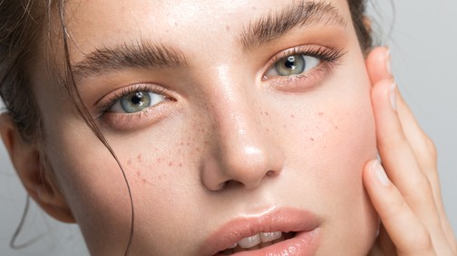 Beauty-tipp: ezeket szerezd be a szemkörnyékápoló szettedbe, hogy mindig üde legyen a tekinteted