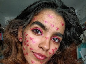 Pattanások az arc különböző részein: ilyen betegségekre utalhatnak