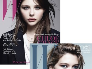 Durcás sztárok a W magazin címlapján