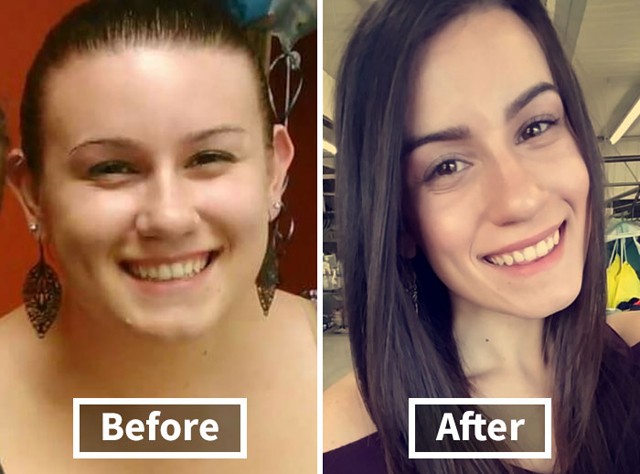 Így változik az ember arca a fogyástól! *Megdöbbentő előtte-utána fotók!*