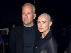 Ijesztő? Szexi? Ezek a nők kopaszra borotválták a fejüket